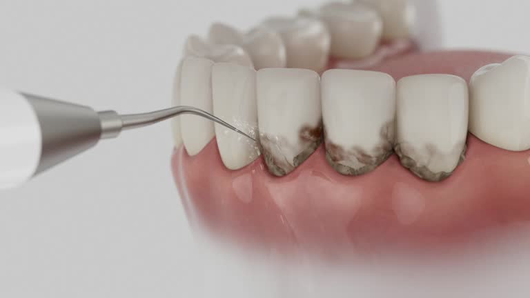 Trusted Teeth Cleaning And Checkup service in Four Bridges, OH - Dentist Open Now
